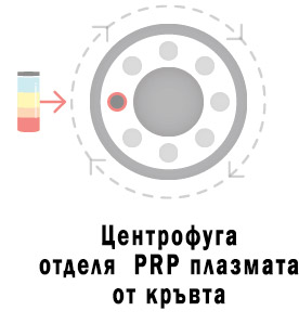 плазмолифтинг терапия PRP терапия варна