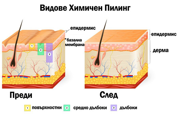 химичен пилинг маски